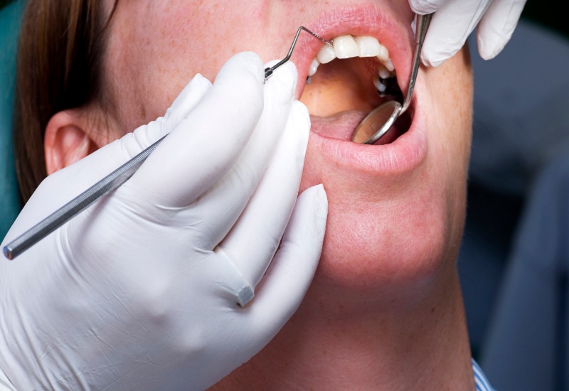 Restorative Dentistry treatment using dental tools on patient’s teeth in Antioch, IL